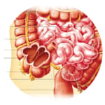 Biologie-Themen Blinddarm