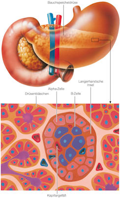 Diabetes (Grafik)