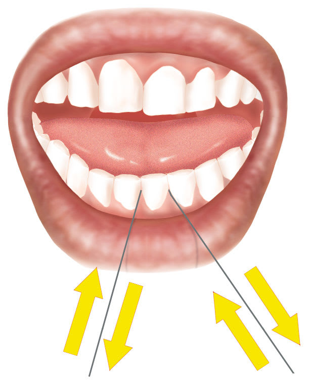 Zahnpflege: Zahnseide