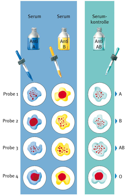 Blutgruppen: Bestimmung