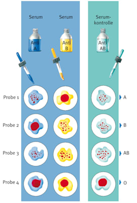 Blutgruppen: Bestimmung