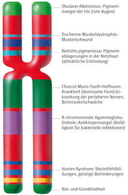 X-Chromosom: vererbte Farbenblindheit