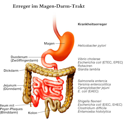 Erreger im Magen-Darm-Trakt (Grafik)