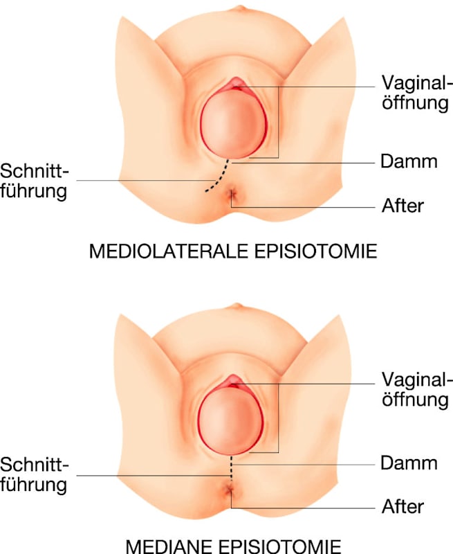 Dammschnitt (Grafik)