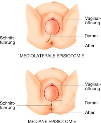 Dammschnitt (Grafik)